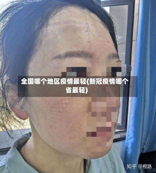 全国哪个地区疫情最轻(新冠疫情哪个省最轻)-第2张图片