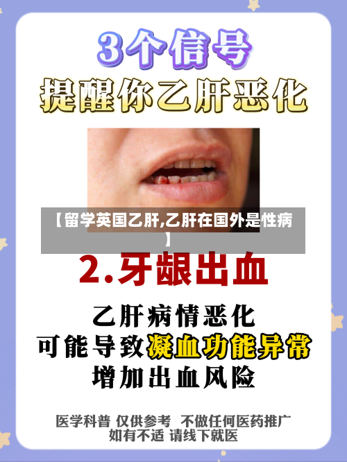 【留学英国乙肝,乙肝在国外是性病】-第2张图片