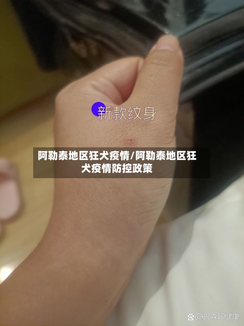 阿勒泰地区狂犬疫情/阿勒泰地区狂犬疫情防控政策-第2张图片