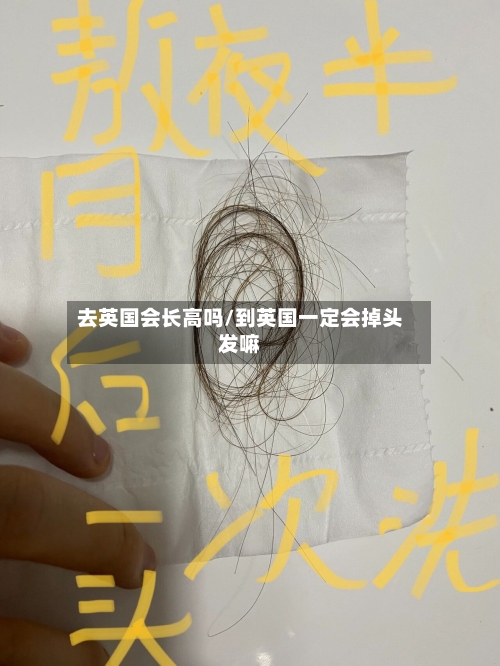 去英国会长高吗/到英国一定会掉头发嘛-第3张图片
