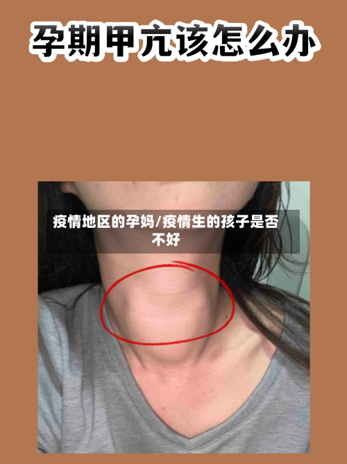 疫情地区的孕妈/疫情生的孩子是否不好