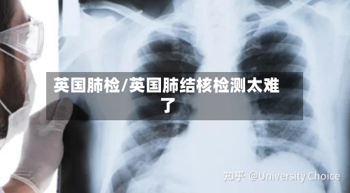 英国肺检/英国肺结核检测太难了-第3张图片
