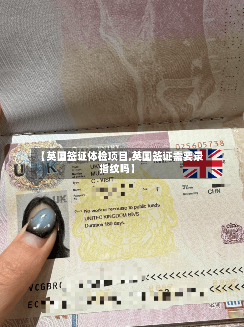 【英国签证体检项目,英国签证需要录指纹吗】